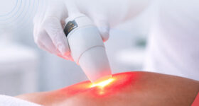 LASER TECHNICIAN ORAL EXAM QUESTIONS